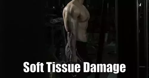 Soft Tissue Damage