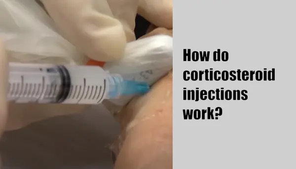 How do corticosteroid injections work?