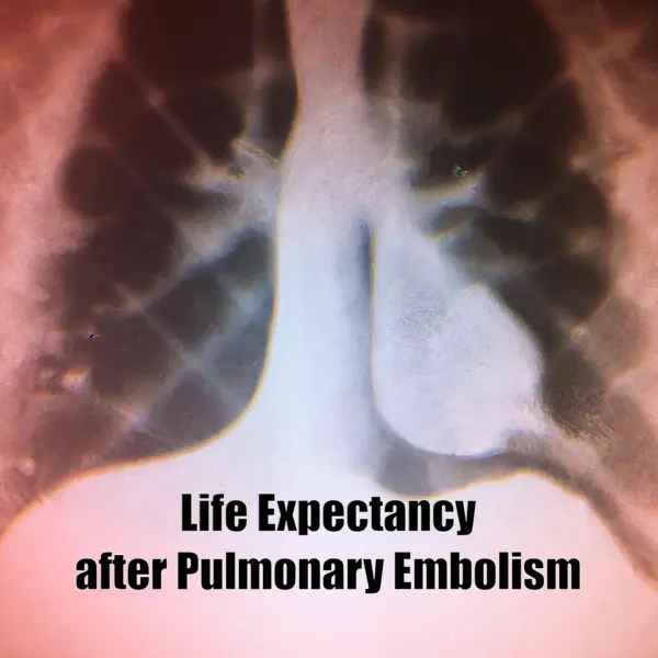 Life Expectancy after Pulmonary Embolism