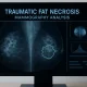 Diagnostic mammography screen showing medical imaging used to identify and analyze traumatic fat necrosis in breast tissue.