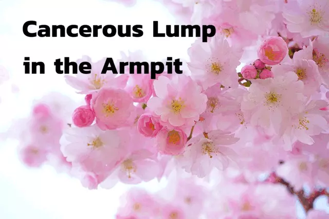 lump-in-armpit