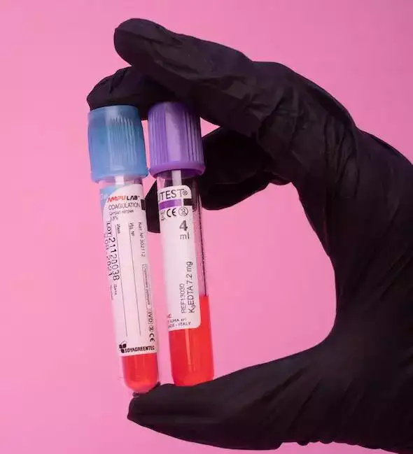 Complete Metabolic Profile (CMP) Blood Test