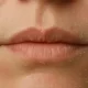 flaky dry skin around the mouth and chin
