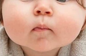 Big Fat Cheeks: How to Remove Them