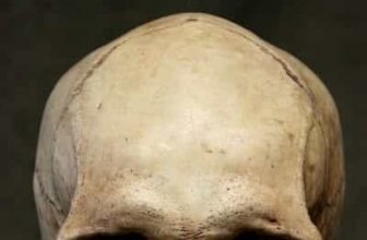 Skull Ridges in Children and Adults